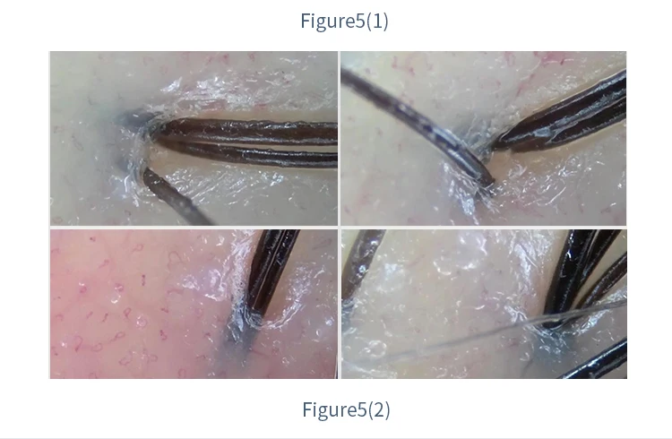 ce 认证 600x 手持式头皮分析显微镜毛囊检测器无线连接手机平板电脑
