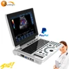 High quality 2D system obstetric gynechology software portable ultrasound sale
