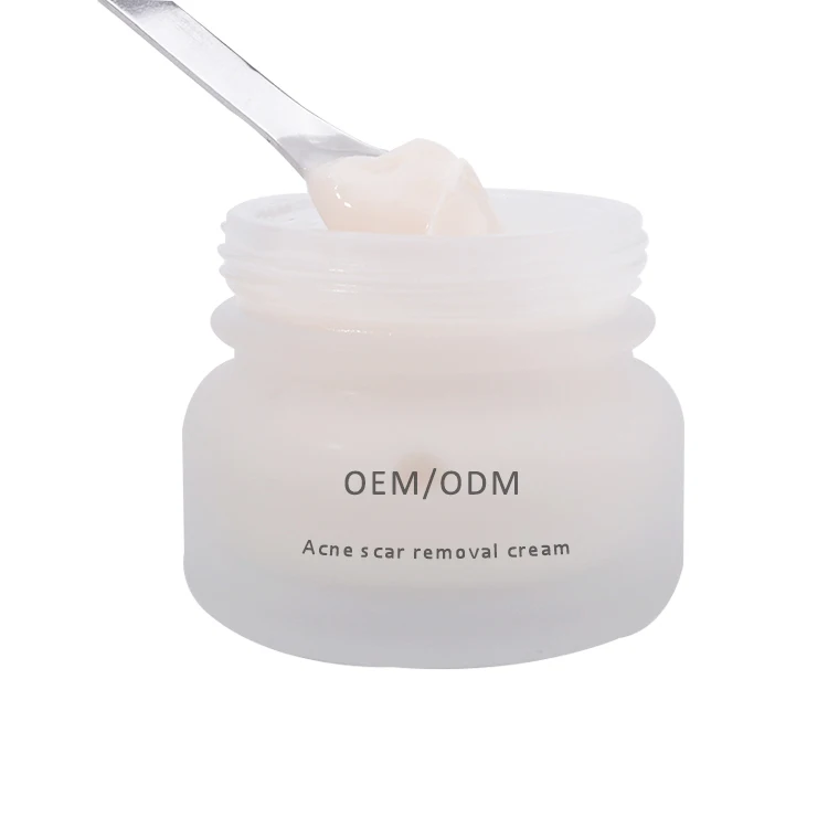 pearl acne cream