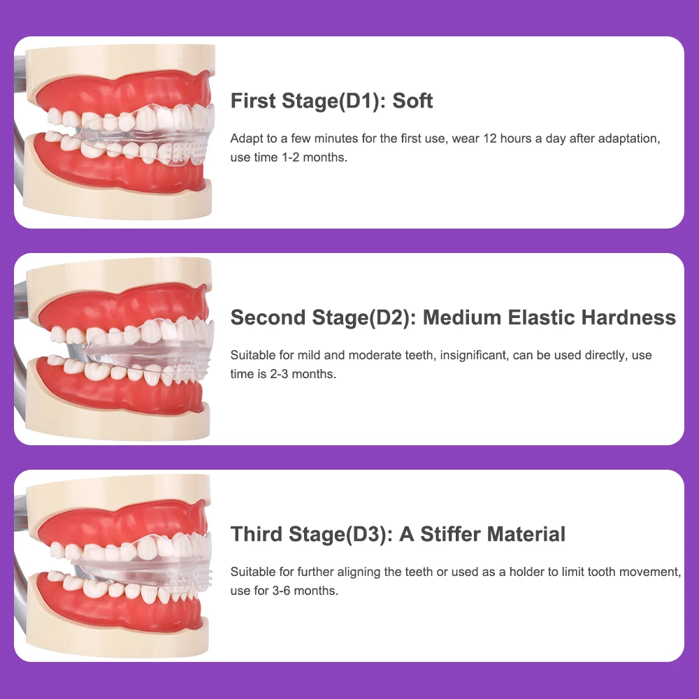 Three-Stage High Quality Case Retainers Straightening Dental Appliance Teeth Trainer Alignment Braces For Tooth Orthodontic.jpg