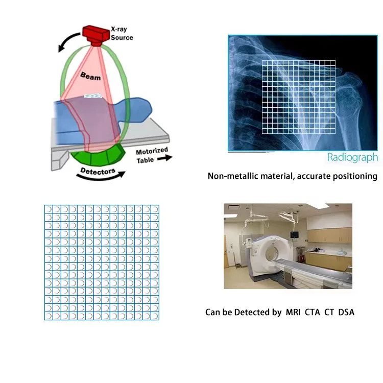 Medical Radiopaque Disposable CT Guided Biopsy Grid