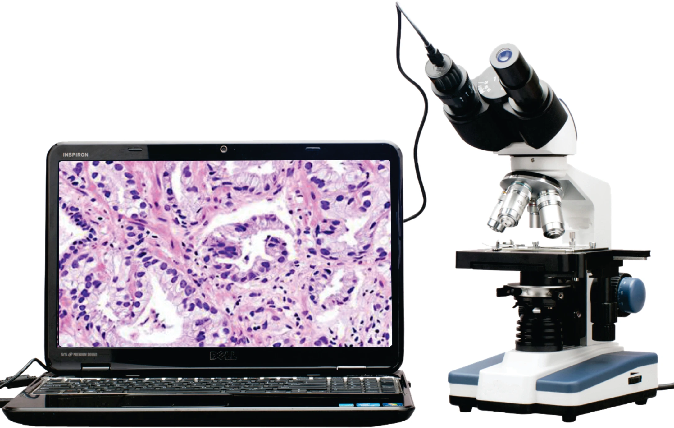 аналоговая телекамера для микроскопа. камера под микроскоп. микроскоп цифровой 2000x usb. камера под микроскоп. камеры для микроскопа adf.