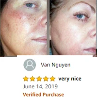 Anti-Acne Cream 4.jpg