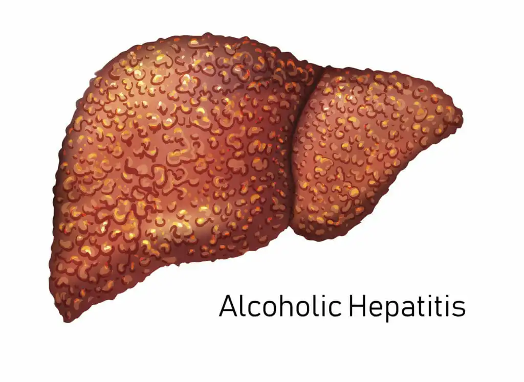 Liver-Hepatitus-1024x747.jpg
