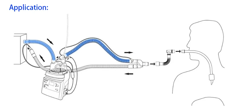 Disposable medical breathing circuit - SHANGHAI TEAMSTAND CORPORATION