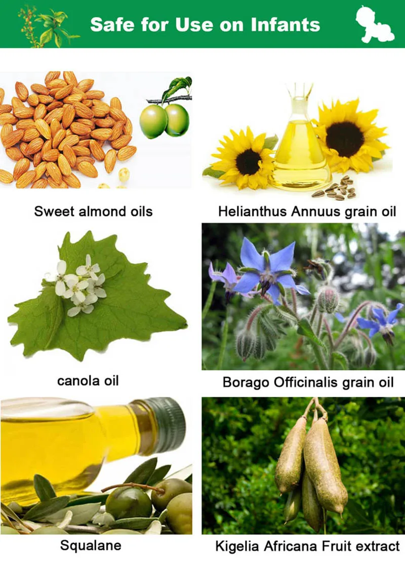 Baby Diaper Rash Treatment Lotion