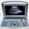Chison eco5 medical color doppler portable 4D ultrasound Scanner