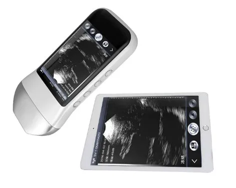 SIFULTRAS-5.4 Linear Built-in Screen Ultrasound Scanner-3.jpeg