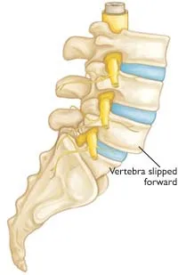 MID ROBO MAX, Spine Decompression Therapy, Chiropractor, Spine, Back bone, Spine solution