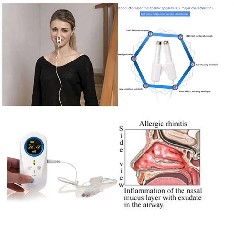 Distributor Wanted Portable Intranasal Light Therapy Device Rhinitis