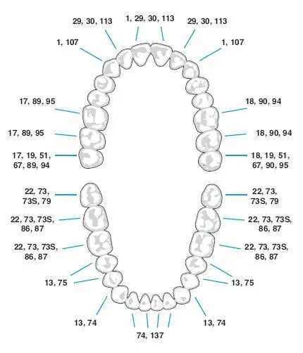 Tooth Extraction Chart