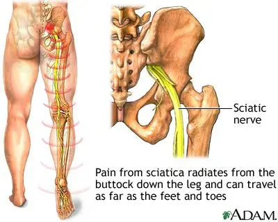 MID ROBO MAX, Spine Decompression Therapy, Chiropractor, Spine, Back bone, Spine solution