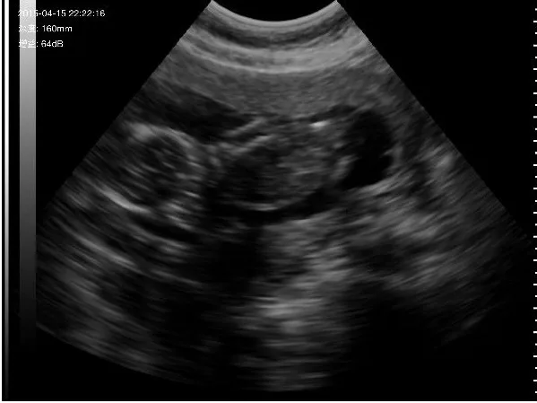 doppler ultrasound pregnancy suppliers