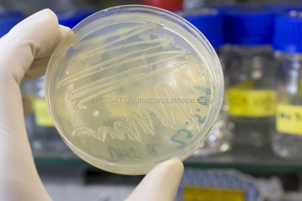 бак посев кала на патогенную кишечную флору. анализ мазка на стафилококк. расшифровка бак посева кала у грудничка. бактериологическое исследование кала норма. бак посев кала на кишечную группу норма.