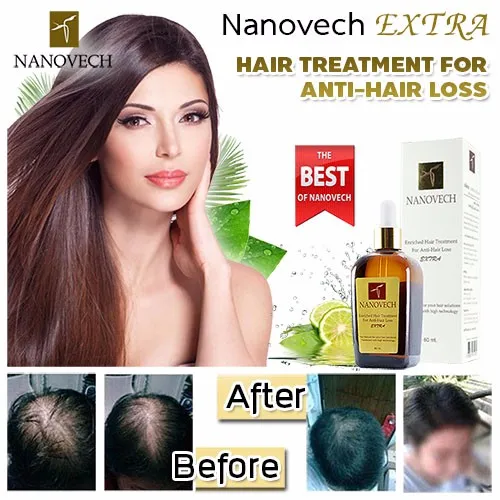Best Quality Herb Anti Hair Loss Products From Thailand Buy Antihair