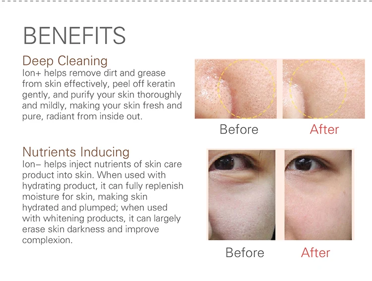 galvanic facial benefits Galvanic facial benefits