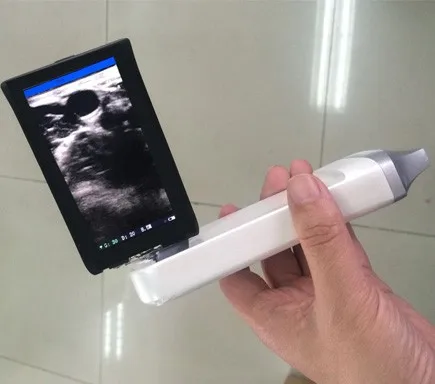 SIFULTRAS-5.4 Built- in  Ultrasound Scanner.jpg