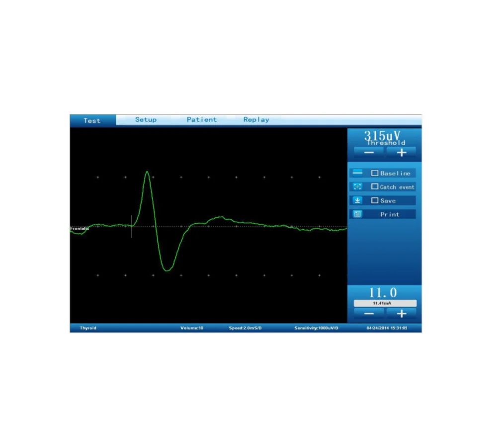 Monitoring test