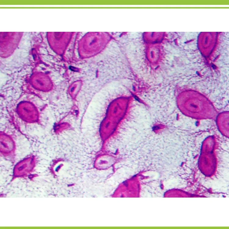 Bacillus mucilaginosus
