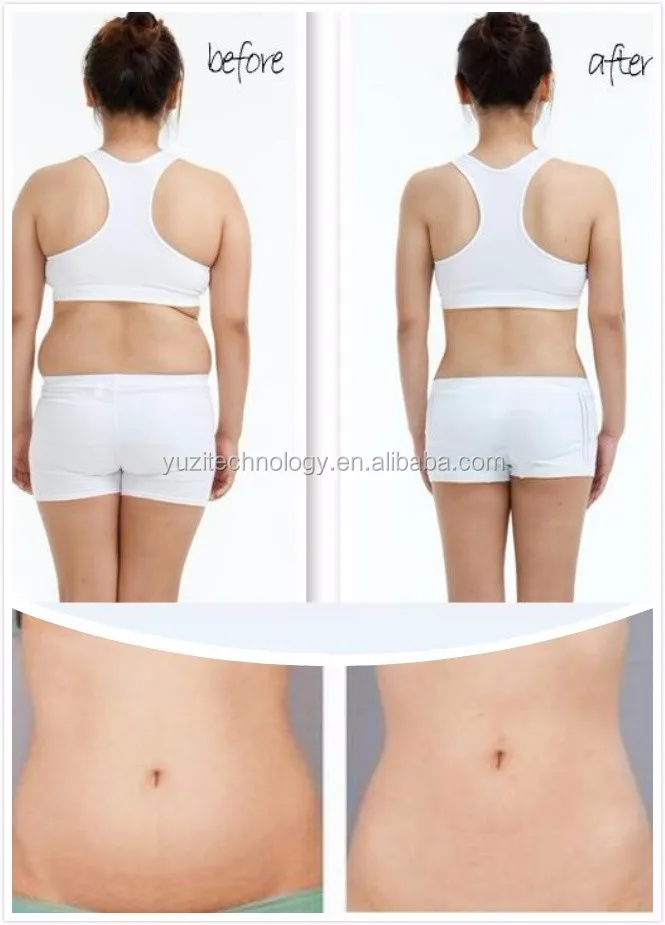 Gambar Bentuk Payudara Terbaik Fat Loss Pressotherapy Selulit Pengurangan Bentuk Payudara Terbaik Fat Loss Pressotherapy Selulit Pengurangan