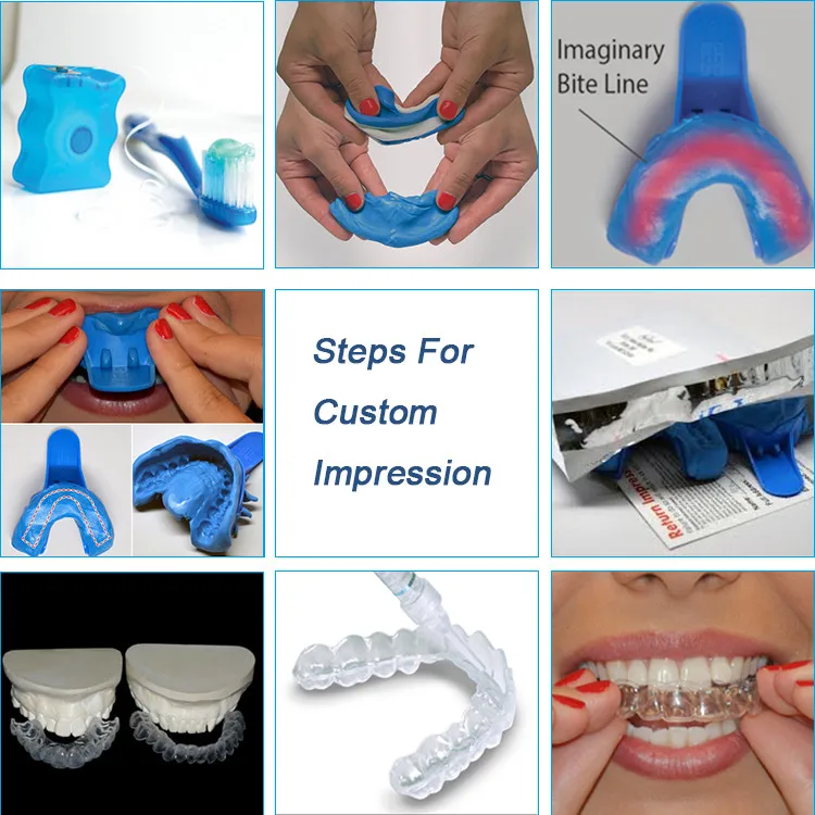 teeth impression mold kit