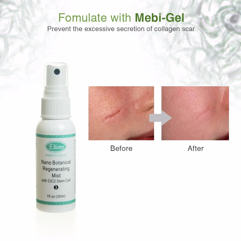 Nano Silver Mist Antibacterial Wound Spray Buy Facial Spray Nano Mist,Wound Spray,Nano Silver