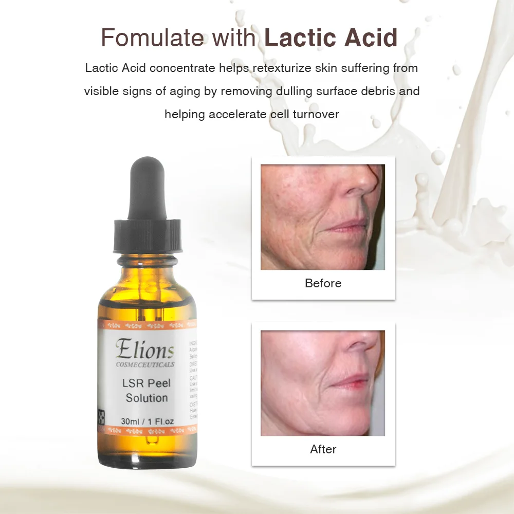 Private Label Lactic Acid Salicylic Acid Resorcinol Anti Acne Skin Care