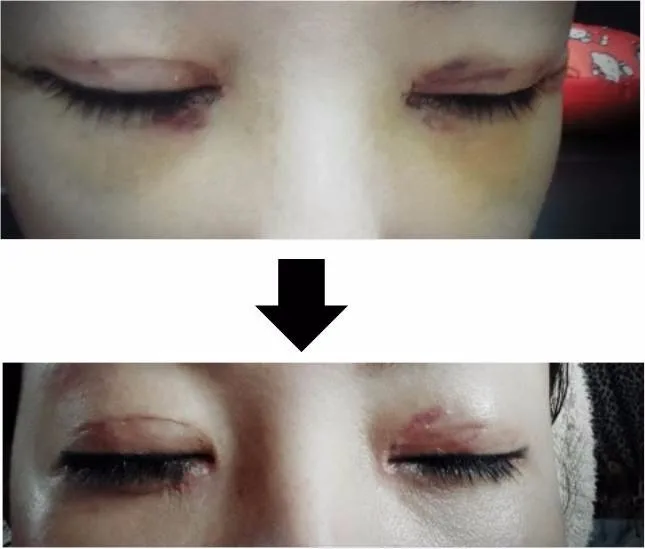 vitamin k1 oxiderm cream