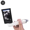 Portable Ultrasound Scanner, Linear Probe 8MHz/12MHz, Wifi, Measures Thyroid, Breast, Vascular, Nerve, MSK, SIFULTRAS-5.4 FDA