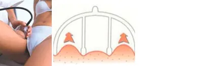 starvac_img03