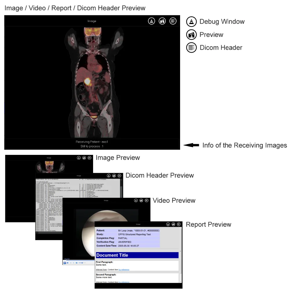 Automated 2drive CD DVD Duplicator & Printer for Medical Images