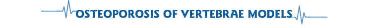 Osteoporosis-of-Vertebrae4.jpg