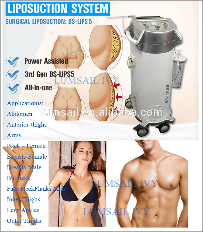 liposuction photo.jpg