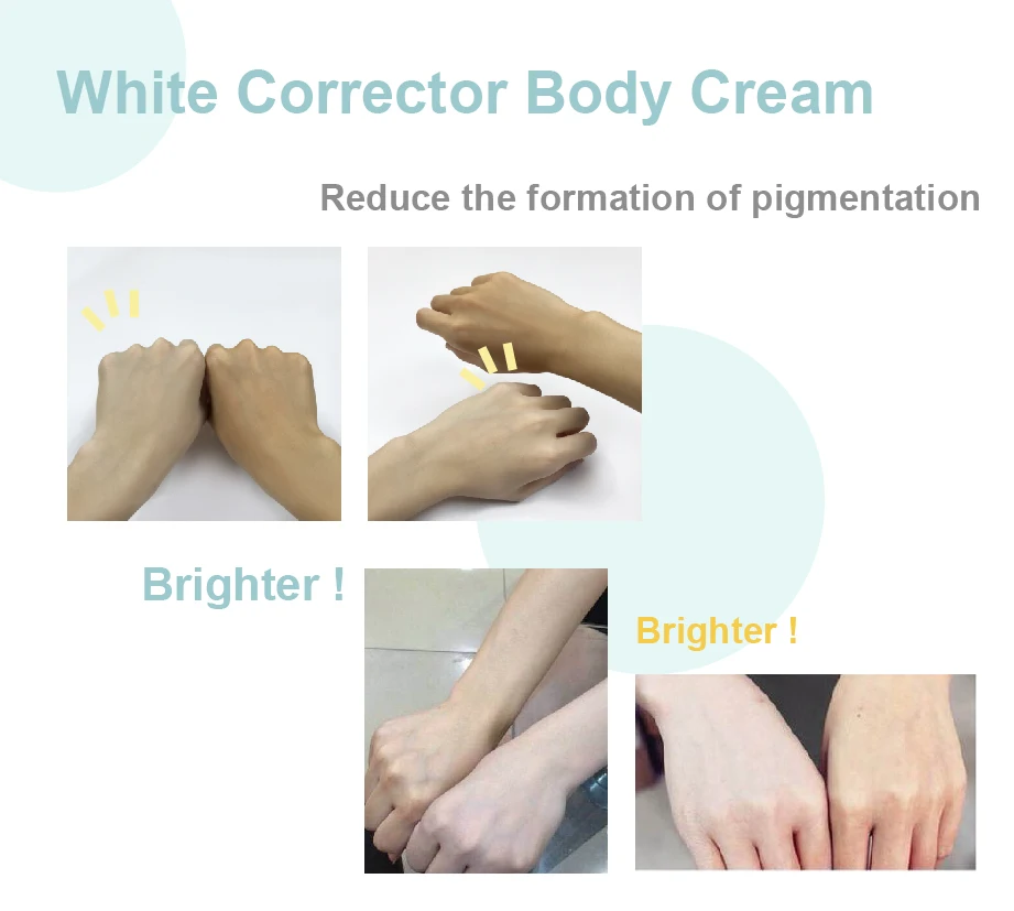 body skin bleaching cream