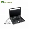 2019 New sale Sonoscape E2 ultrasound scanner, portable color doppler ultrasound machine