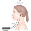 Cranial Electrotherapy Stimulation Devices Exporter in India