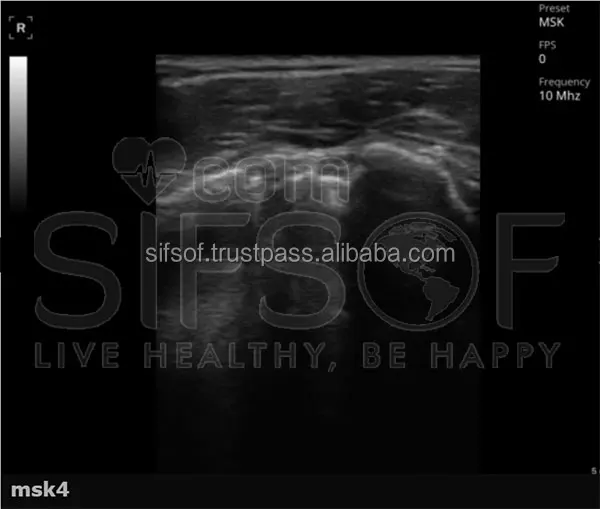 linear-ultrasound.jpg