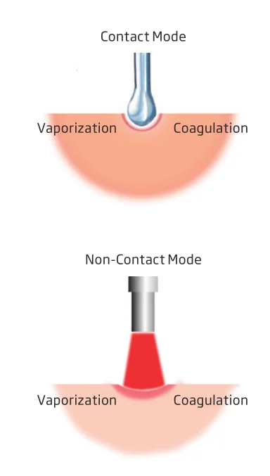 45 Watts ENT Plastic Surgical Diode Laser For Nose And Para - Nasal Sinuses
