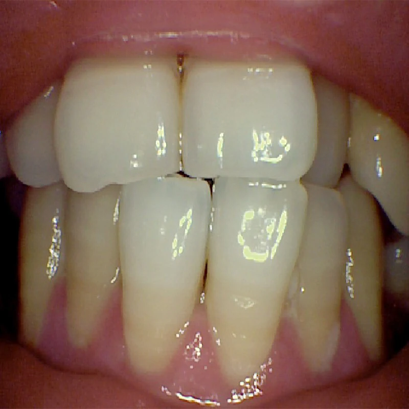 dental oral camera 27.jpg