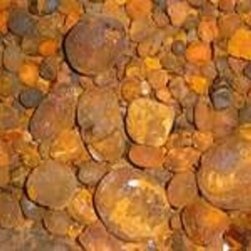 gallstones3.jpg
