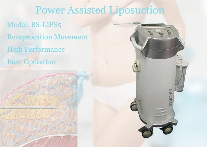 Power Assisted Liposuction Body Slimming Machine Ultrasound Liposuction