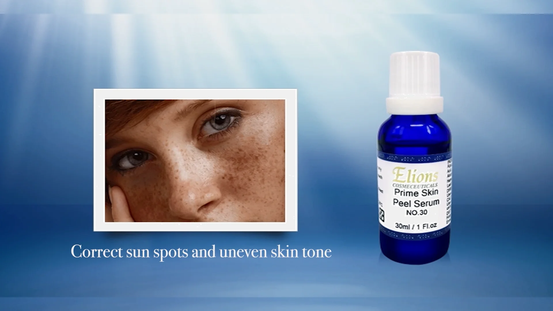 Best Medical Facial Peel 30 Reduce Melanin Aqua Peeling Skin Care