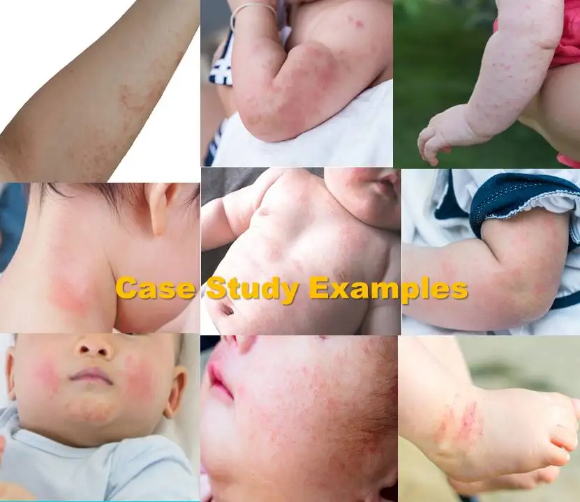 baby cream_case example.jpg