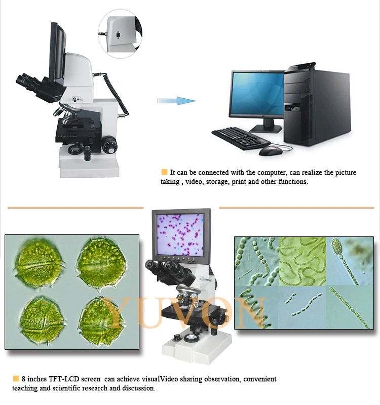 YCSP-8D2 40x-100x high quality biological digital microscope with lcd screen