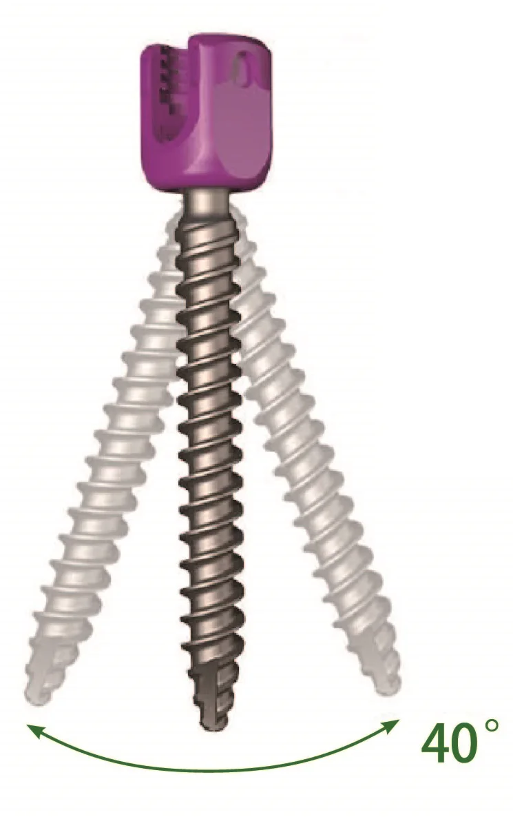Spinal Pedicle Screw And Rod Fixation System For Titanium Orthopedic
