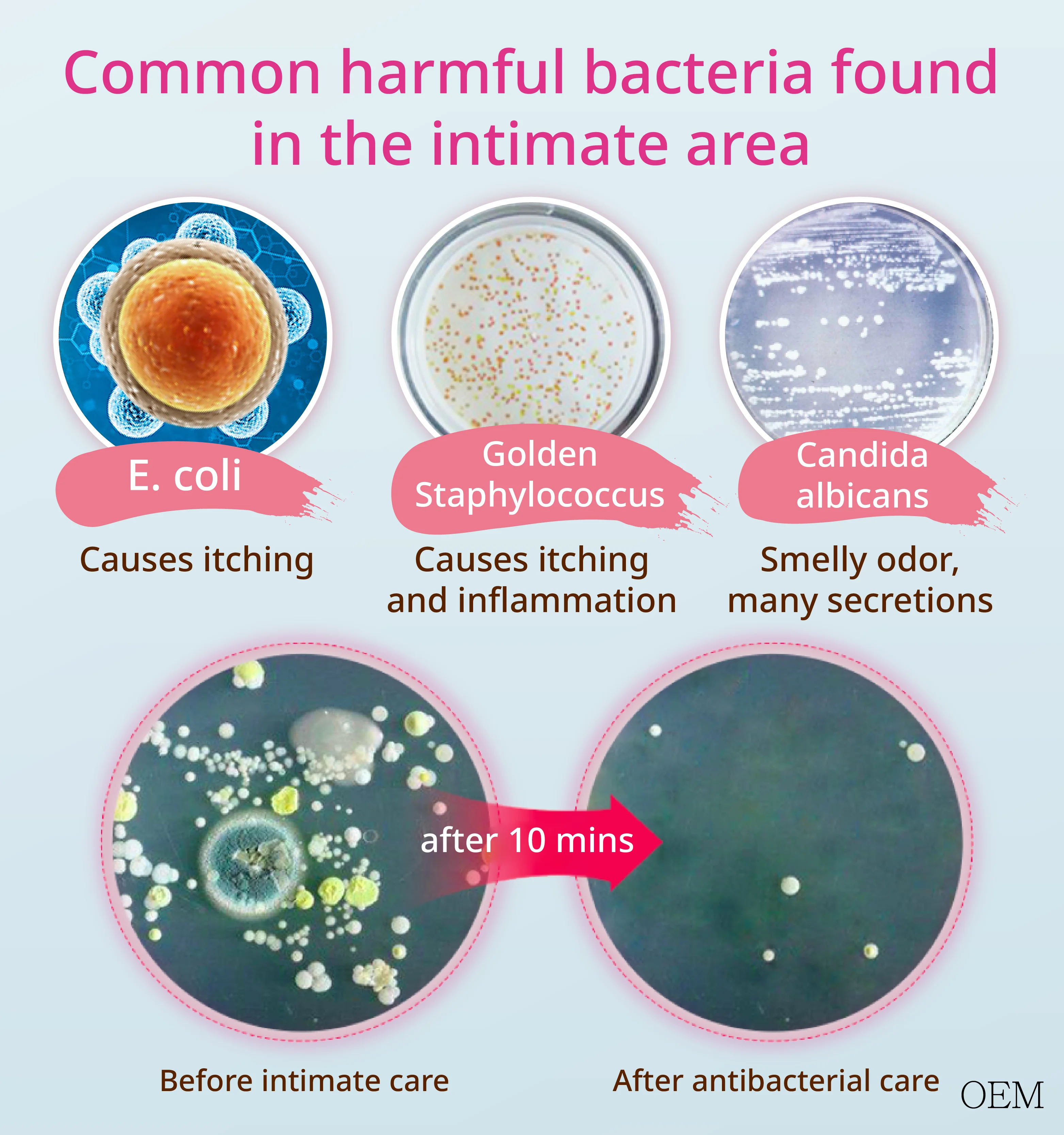 vaginal probiotics